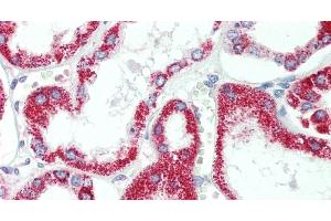Immunohistochemistry of paraffin-embedded Human Kidney using HSD17B8 Polyclonal Antibody at dilution of 1:100. (HSD17B8 抗体)