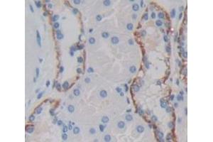 IHC-P analysis of Human Tissue, with DAB staining. (IL18RAP 抗体  (AA 310-451))