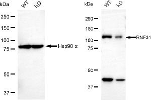 Western blotting analysis using RNF31 antibody (ABIN7800250). (RNF31 抗体)