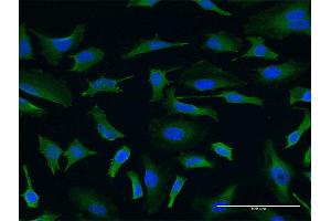 Immunofluorescence of monoclonal antibody to USP9X on HeLa cell. (USP9X 抗体  (AA 1-90))
