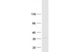 Western Blotting (WB) image for Solute Carrier Family 25 (Carnitine/acylcarnitine Translocase), Member 20 (SLC25A20) protein (Myc-DYKDDDDK Tag) (ABIN2732158)