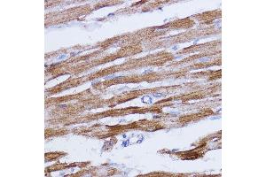 Immunohistochemistry of paraffin-embedded rat heart using NDUFB7 antibody (ABIN6132403, ABIN6144480, ABIN6144481 and ABIN6217781) at dilution of 1:100 (40x lens). (NDUFB7 抗体  (AA 1-137))