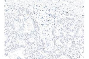 Immunohistochemistry (IHC) image for anti-Zinc Finger CCCH-Type Containing 4 (ZC3H4) (AA 1050-1100) antibody (ABIN7795758)