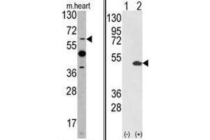 Image no. 3 for anti-Ets Variant 4 (ETV4) (AA 426-455), (C-Term) antibody (ABIN452983) (ETV4 抗体  (C-Term))
