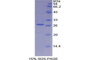 SDS-PAGE analysis of Rat IL2Ra Protein. (CD25 蛋白)