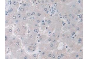 Detection of IDH2 in Human Liver Tissue using Polyclonal Antibody to Isocitrate Dehydrogenase 2, mitochondrial (IDH2)