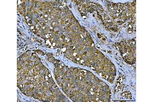 IHC analysis of TMC7 using anti-TMC7 antibody (ABIN7602499). (TMC7 抗体  (AA 8-723))