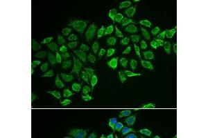 Immunofluorescence analysis of MCF-7 cells using RHOD Polyclonal Antibody (RHOD 抗体)