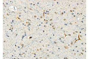anti-Glycoprotein Hormones, alpha Polypeptide (CGA) (Internal Region) antibody