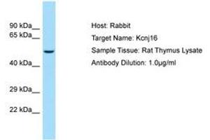 Image no. 1 for anti-Potassium Inwardly-Rectifying Channel, Subfamily J, Member 16 (KCNJ16) (AA 280-329) antibody (ABIN6749836) (KIR5.1 抗体  (AA 280-329))