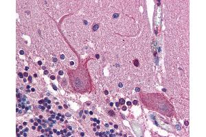 Immunohistochemistry (IHC) image for anti-Adaptor-Related Protein Complex 1, gamma 1 Subunit (AP1G1) (AA 574-623) antibody (ABIN6747137)