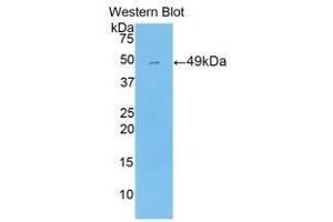 Western blot analysis of the recombinant protein. (NR1I2 抗体  (AA 205-390))