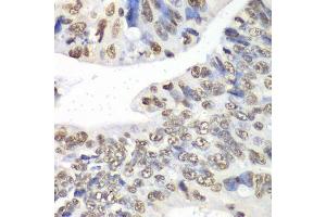 Immunohistochemistry of paraffin-embedded human colon using Nono Antibody. (NONO 抗体  (AA 1-300))