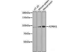 Western blot analysis of extracts of various cell lines using ADRBK1 Polyclonal Antibody at dilution of 1:1000. (GRK2 抗体)