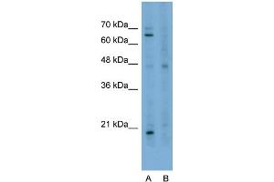 Host:  Rabbit  Target Name:  STAU1  Sample Type:  HepG2  Lane A:  Primary Antibody  Lane B:  Primary Antibody + Blocking Peptide  Primary Antibody Concentration:  2. (STAU1/Staufen 抗体  (N-Term))