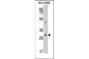 Western blot analysis of anti-CASP3 Pab in NCI-H460 cell line lysates (35ug/lane). (Caspase 3 抗体  (Middle Region))