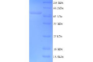 VL2 (AA 1-462), (full length) protein (His tag)
