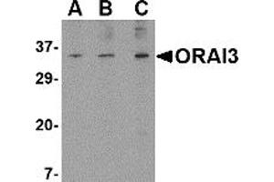 Image no. 1 for anti-ORAI Calcium Release-Activated Calcium Modulator 3 (ORAI3) (N-Term) antibody (ABIN203697) (ORAI3 抗体  (N-Term))