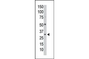 The anti-P1CC Pab (ABIN392845 and ABIN2842267) is used in Western blot to detect P1CC in mouse colon tissue lysate.