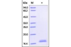 SDS-PAGE (SDS) image for Tumor Necrosis Factor alpha (TNF alpha) (AA 77-233) (Active) protein (Biotin) (ABIN2181833)