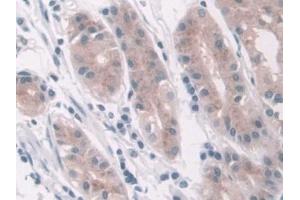Detection of LDHD in Human Stomach Tissue using Polyclonal Antibody to Lactate Dehydrogenase D (LDHD) (LDHD 抗体  (AA 62-265))