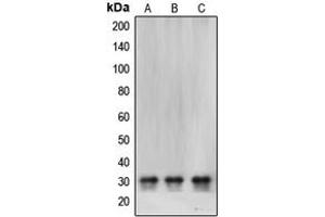 Western blot analysis of CBR1 expression in SHSY5Y (A), HeLa (B), MCF7 (C) whole cell lysates. (CBR1 抗体  (Center))