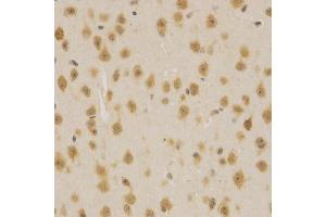 Immunohistochemistry of paraffin-embedded mouse brain using MDM2 Antibody (ABIN5970136) at dilution of 1/200 (40x lens). (MDM2 抗体)