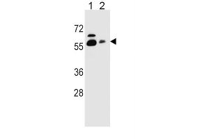 Western Blotting (WB) image for anti-Sodium Dependent Vitamin C Transporter 1 (SVCT1) antibody (ABIN2996906)