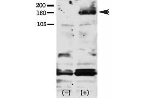 Western blot testing of phospho-HER4 antibody and FG pancreatic carcinoma cells treated with or without EGF (50ng/ml) for 15 min.