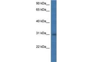 Image no. 1 for anti-Major Histocompatibility Complex, Class II, DM alpha (HLA-DMA) (AA 58-107) antibody (ABIN6746965)