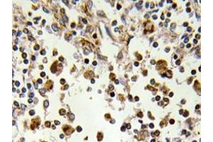 Immunohistochemistry analyzes of MSK1 antibody in paraffin-embedded human lymph node tissue. (MSK1 抗体)