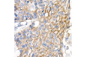 Immunohistochemistry (IHC) image for anti-Catenin (Cadherin-Associated Protein), delta 1 (CTNND1) antibody (ABIN7266144)