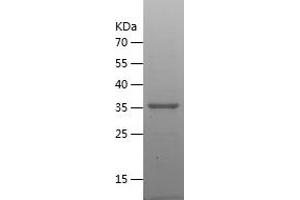 DHRS9 Protein (AA 18-319) (His tag)