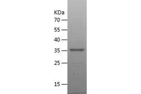 DHRS9 Protein (AA 18-319) (His tag)