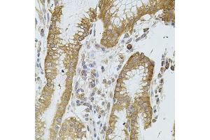 Immunohistochemistry of paraffin-embedded human stomach using CYBB antibody. (CYBB 抗体)
