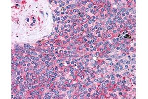 Anti-LST1 antibody IHC of human spleen.