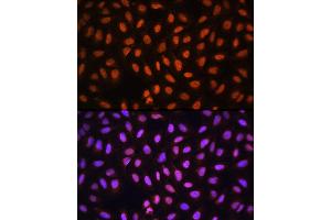 Immunofluorescence analysis of U-2 OS cells using MCM5 Rabbit pAb (ABIN6132074, ABIN6143644, ABIN6143646 and ABIN6217542) at dilution of 1:100 (40x lens). (MCM5 抗体  (AA 1-230))