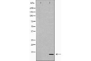 Western blot analysis of extracts of Recombinant protein, using NRG4 antibody. (Neuregulin 4 抗体  (C-Term))