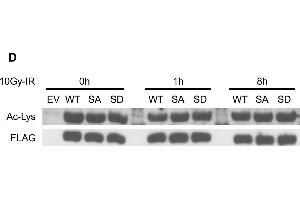Western Blotting (WB) image for anti-Acetylated Lysine antibody (ABIN5596809)