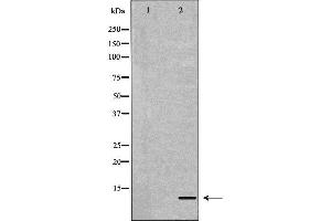 Apolipoprotein C-II 抗体  (Internal Region)