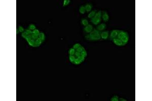 Immunofluorescent analysis of PC-3 cells using ABIN7164089 at dilution of 1:100 and Alexa Fluor 488-congugated AffiniPure Goat Anti-Rabbit IgG(H+L) (PRDM16 抗体  (AA 448-683))