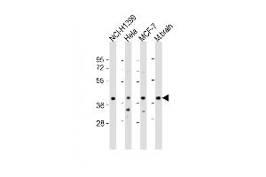 All lanes : Anti-TWF1 Antibody (Center) at 1:2000 dilution Lane 1: NCI- whole cell lysate Lane 2: Hela whole cell lysate Lane 3: MCF-7 whole cell lysate Lane 4: mouse brain lysate Lysates/proteins at 20 μg per lane. (TWF1 抗体  (AA 201-235))