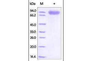 SDS-PAGE (SDS) image for Receptor Tyrosine Kinase-Like Orphan Receptor 1 (ROR1) (AA 30-403) protein (Fc Tag) (ABIN2181703)