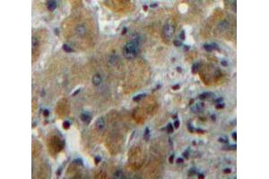 Used in DAB staining on fromalin fixed paraffin-embedded Liver tissue (MUC6 抗体  (AA 2338-2439))