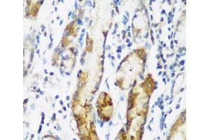 Immunohistochemistry of paraffin-embedded Human gastric using NAA60 Polyclonal Antibody at dilution of 1:200 (40x lens). (NAT15 抗体)
