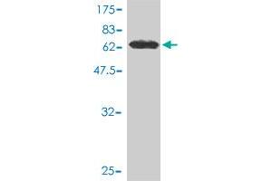Western Blotting (WB) image for anti-Signal Transducer and Activator of Transcription 5B (STAT5B) (AA 1-390) antibody (ABIN563035)