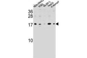 Western Blotting (WB) image for anti-S100 Calcium Binding Protein Z (S100Z) antibody (ABIN2995739) (S100Z 抗体)