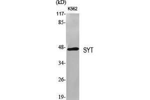 Western Blot (WB) analysis of specific cells using SYT Polyclonal Antibody. (SS18 抗体  (N-Term))