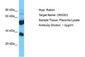 Host: Rabbit Target Name: OR52E2 Sample Type: Placenta lysates Antibody Dilution: 1. (OR52E2 抗体  (C-Term))