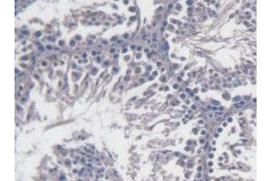 Detection of CRISP1 in Mouse Testis Tissue using Polyclonal Antibody to Cysteine Rich Secretory Protein 1 (CRISP1) (CRISP1 抗体  (AA 20-244))